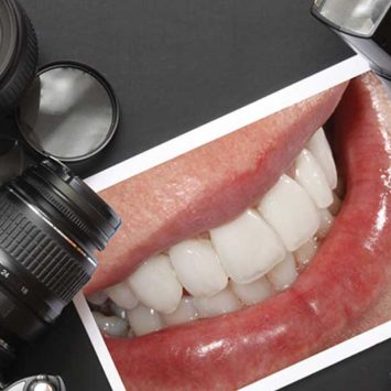 Dental Photography: An Insight