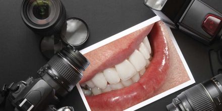 Dental Photography: An Insight