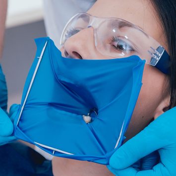 The Ultimate Guide to Using Dental Dam for Dental Treatment