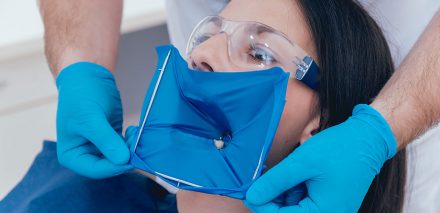 The Ultimate Guide to Using Dental Dam for Dental Treatment