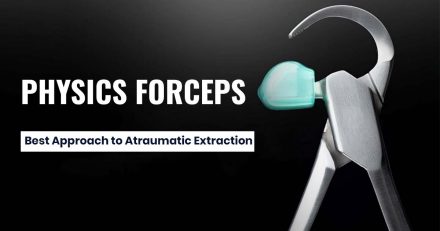 PHYSICS FORCEPS: Best Approach to Atraumatic Extraction