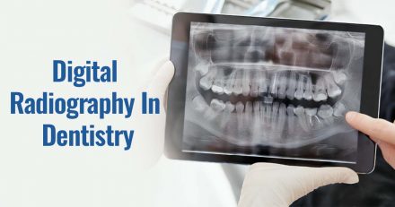 Digital Radiography in Dentistry