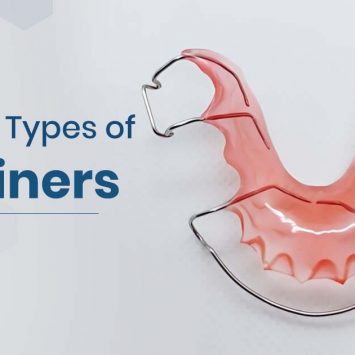 Types of Retainers in Dentistry: Removable Vs Permanent