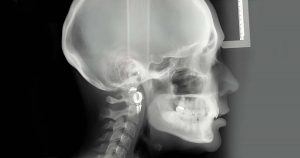 Cephalometric X-rays