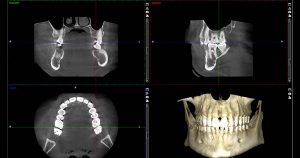 Cone beam computed tomography