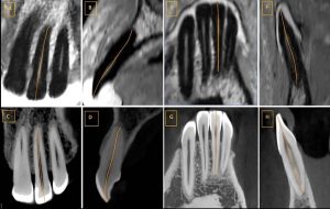 Magnetic Resonance Imaging