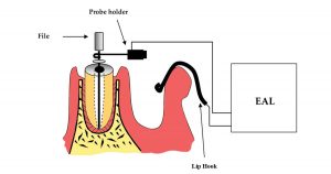 how does an electronic apex locator works