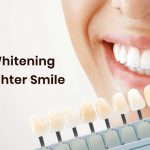 Teeth Whitening for a Brighter Smile