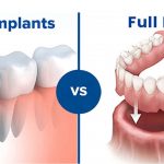 denture and dental implant