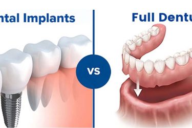 denture and dental implant