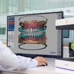 Ultimate Guide To 3D Printing in Dentistry