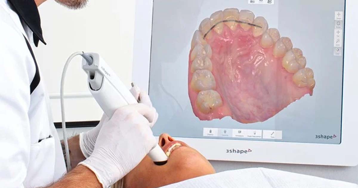 Integrating Digital Dentistry into the Curriculum