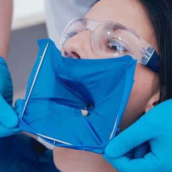 Dental Rubber Dam Guide: Improve Isolation, Safety, and Visibility