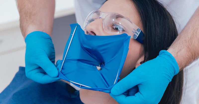 Dental Rubber Dam Guide: Improve Isolation, Safety, and Visibility