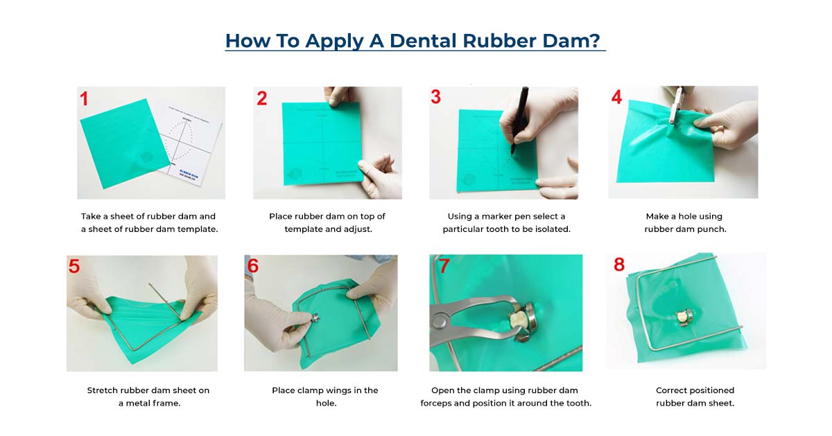 How to Apply a Dental Rubber Dam