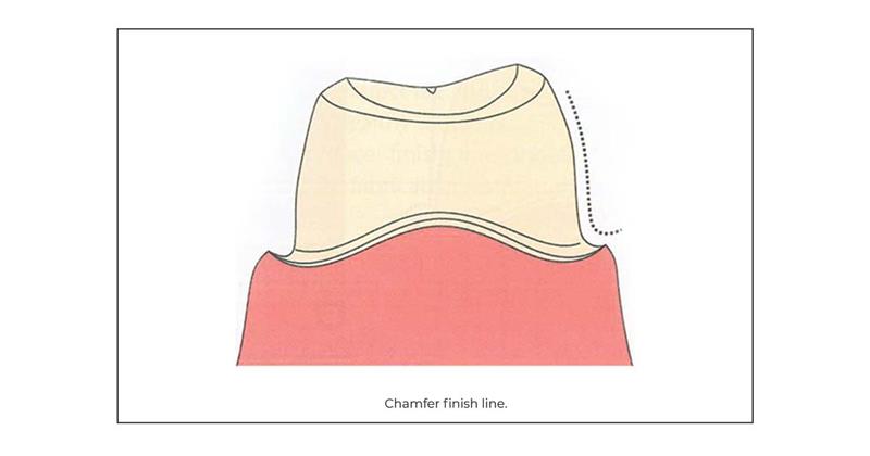 Chamfer line