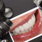 dental photography
