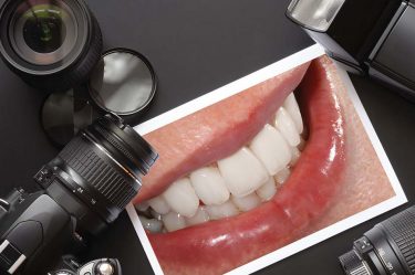 dental photography