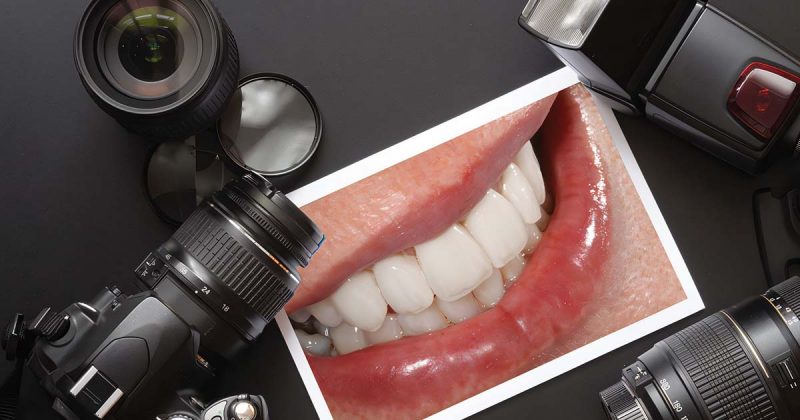 Dental Photography in 2025: The Ultimate Beginner’s Guide for Dentists Dental Photography in 2025: The Ultimate Beginner’s Guide for Dentists