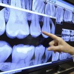 Digital Radiography