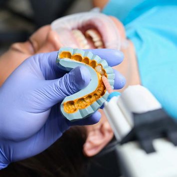 A Comprehensive Overview of Dental Impression Materials for Accurate Restorations