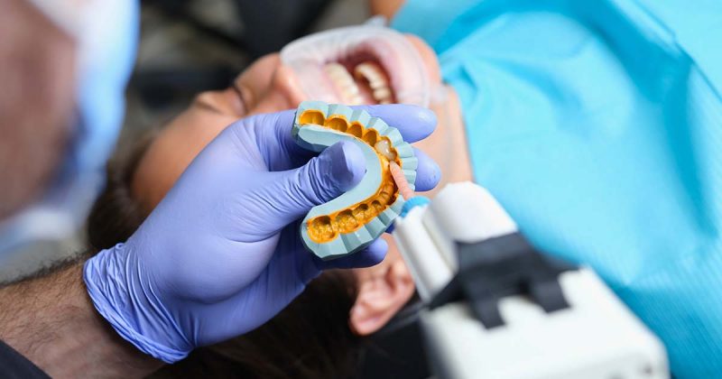 A Comprehensive Overview of Dental Impression Materials for Accurate Restorations A Comprehensive Overview of Dental Impression Materials for Accurate Restorations