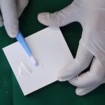 Glass Ionomer Cements GIC