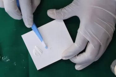 Glass Ionomer Cements GIC