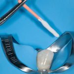 Emerging Bioceramic Materials in Endodontics
