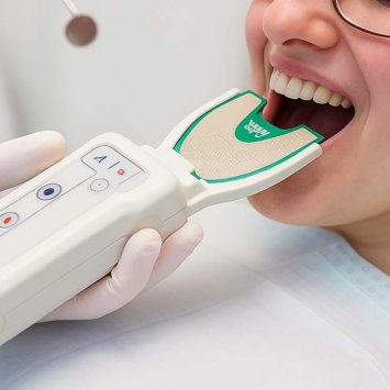 Digital Occlusion Analysis: The Future of Bite Correction 