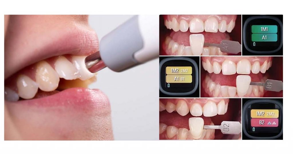 Digital shadematching devices