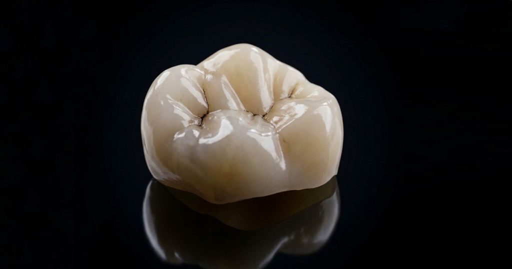 characterization and surface conditioning of a tooth