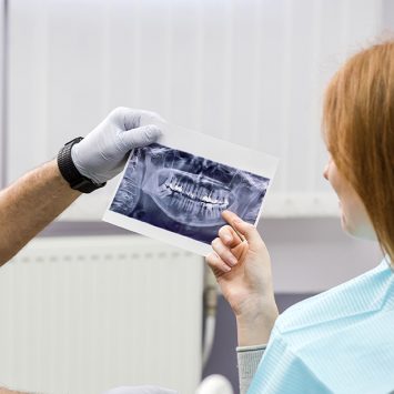 How to Read and Interpret Dental X-Rays: Beginner’s Guide for Students 