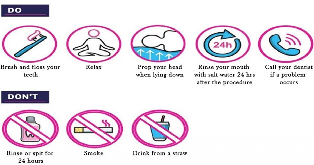 Do's and Don'ts of post periodontal surgery.