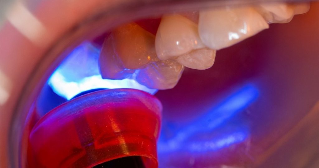 curing tip distance from surface