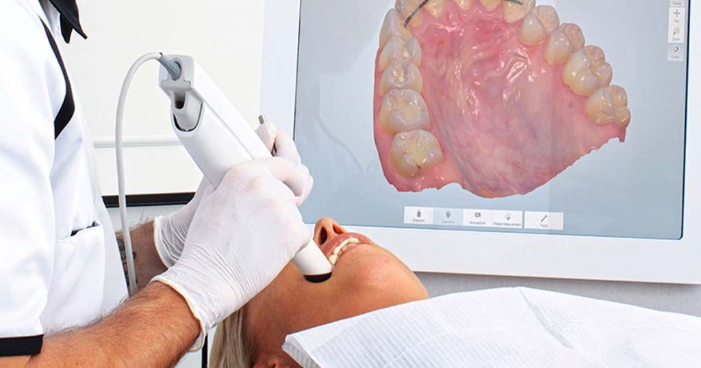 dental scanner