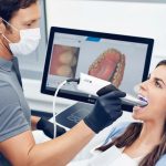 dental scanners
