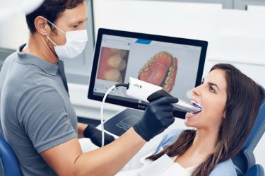 dental scanners