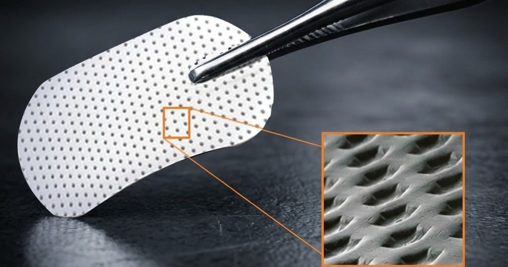 ePTFE membrane for GBR.