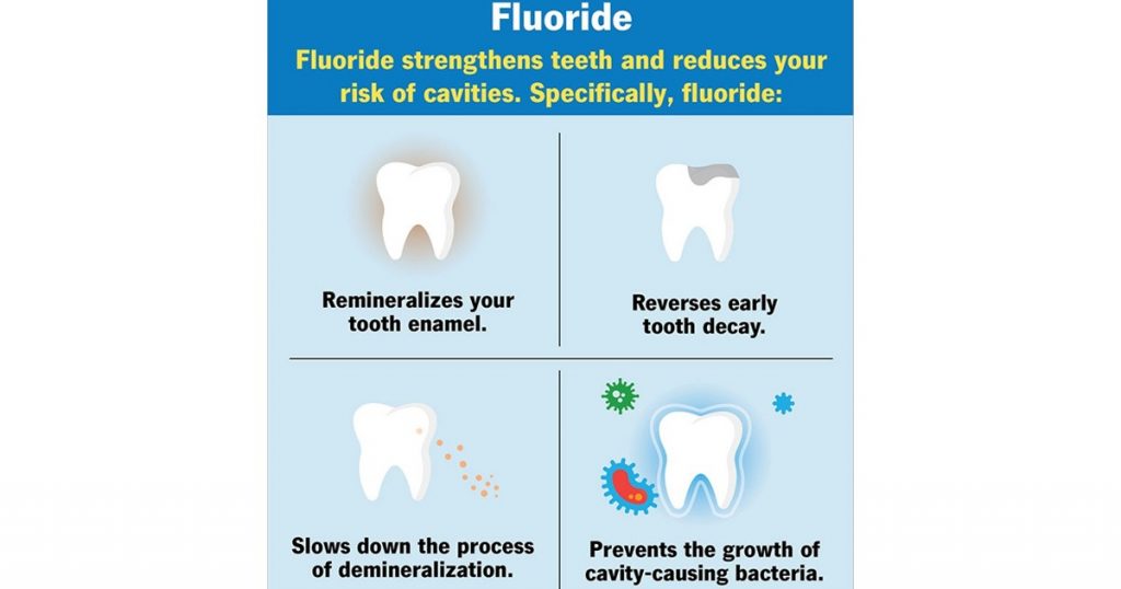 fluoride application on teeth
