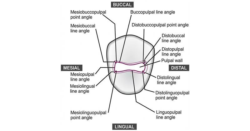 reduce internal lines