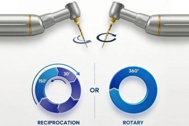 rotary vs reciprocating files