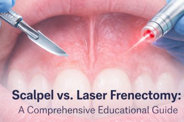 scalpel vs laser frenectomy