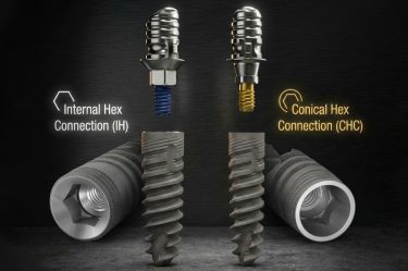 internal hex and conical connections