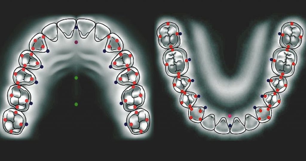 Occlusion Management