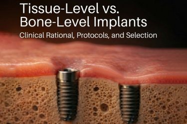 tissue level and bone level implants